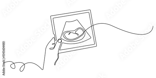 continuous line hand holding ultrasound photo of baby.scan photo of baby in womb.single line illustration.eps 10