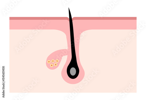 Cross Section of Healthy Skin and Hair Follicle