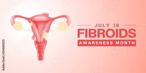 July Is Fibroids Awareness Month. Female reproductive organs. Suitable for posters, banners and social media. White and pink background.