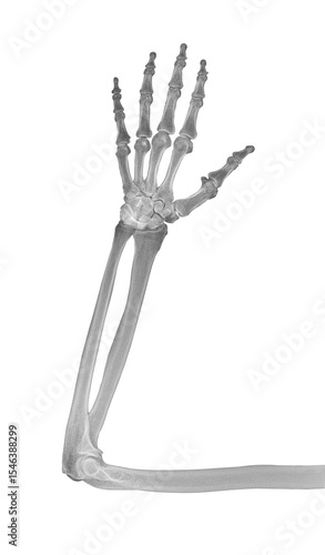 On a white background, a part of the skeleton of the arm and forearm bones in a direct projection. PNG