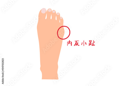内反小趾の主線なしシンプルイラスト素材