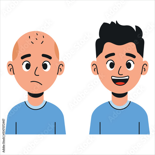 Sad bald man contrasted with happy long haired man vector. Hair loss and treatment concept in flat cartoon style.