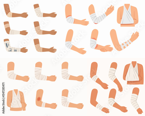 Vector Set Injured human arms. Bandaged elbows and forearms, damaged arm parts, emergency treatment for bones fractures and sprains flat vector illustration set. Physical injury bandages