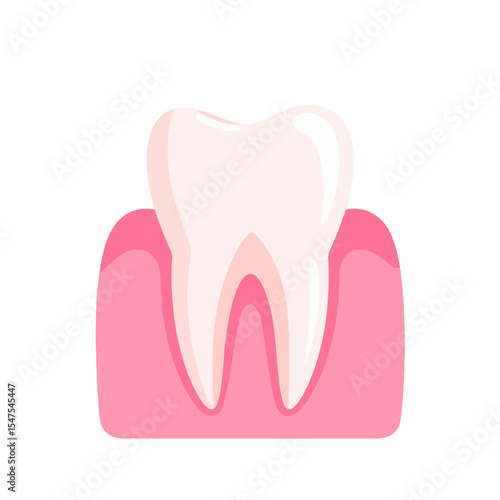 A tooth is depicted in pink gums with a white and tan tooth