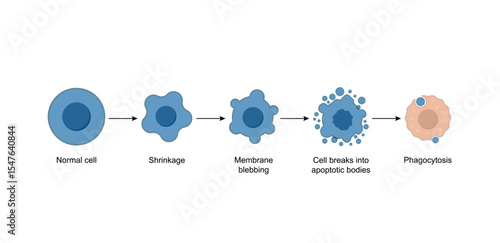 Apoptosis. Programmed cell death. Aging process in cells. Stages of apoptosis, normal cell, shrinkage, membrane blebbing, cell breaks into apoptotic bodies and phagocytosis. Vector illustration.