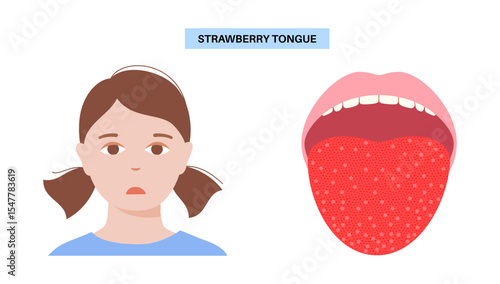 Strawberry tongue poster