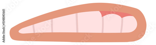 Gums covering teeth display signs of gingivitis, a prevalent gum disease characterized by swollen, red gums that bleed easily and indicate potential oral health issues