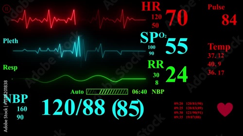 vital signs on ICU monitor in hospital, Intensive care health monitor with stable vital signs, patient's condition illness. glowing emergency health monitor ui design,intensive care unit monitor bc.
