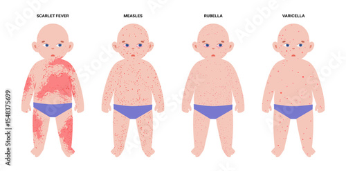 The most common viral rashes