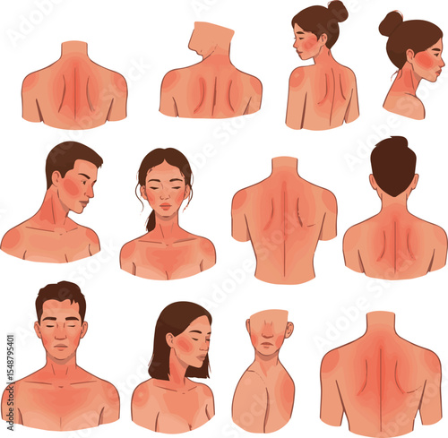 Create a kinds of deferent Sunburn vector art with white background.