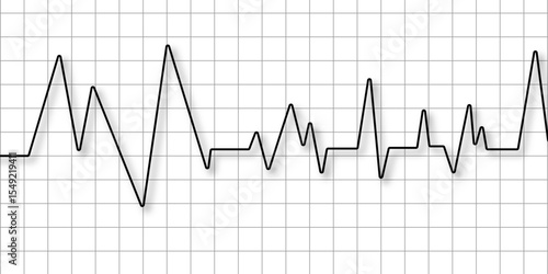 Heart disease cardiogram. Increasing amplitude pulse rate, sawtooth wave, increasing amplitude wave. Heart pulse monitor with signal. Electrocardiogram. Medical healthcare symbol. vector.             