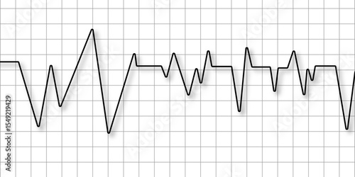 Heart disease cardiogram. Increasing amplitude pulse rate, sawtooth wave, increasing amplitude wave. Heart pulse monitor with signal. Electrocardiogram. Medical healthcare symbol. vector.             
