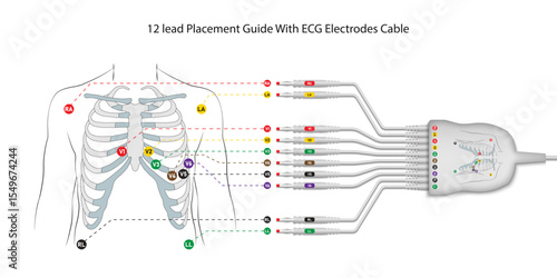12 lead electrocardiograph placement guide