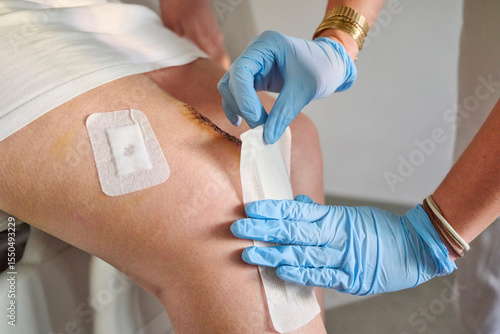 Gloved nurse’s hands changing the dressing over a stapled surgical wound after knee arthroplasty