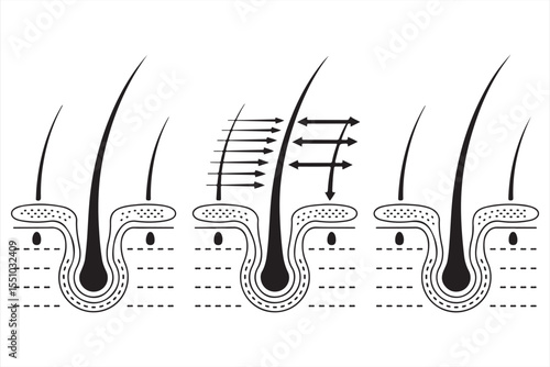 Hair follicle anatomy with directional growth indicators vector