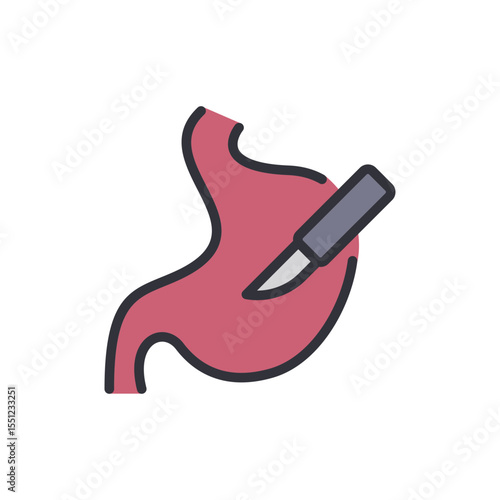 Stomach Surgery Illustration Showing Resection Procedure On Human Anatomy