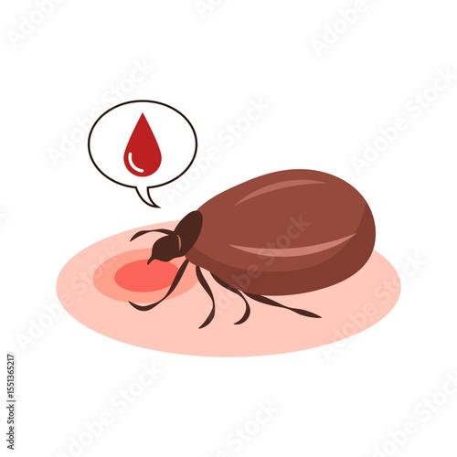 Illustration of a tick sucking blood from the skin. Close-up of a tick bite.