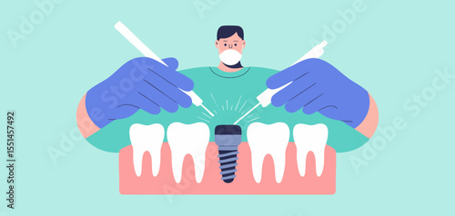 dentist performing dental implant surgery with tools on teeth row, vector illustration for dental implant procedure, oral surgery and restorative dentistry
