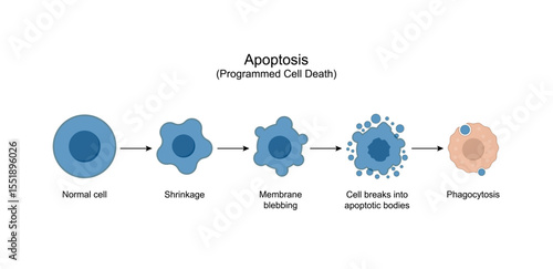Apoptosis. Programmed cell death. Aging process in cells. Stages of apoptosis, normal cell, shrinkage, membrane blebbing, cell breaks into apoptotic bodies and phagocytosis. Vector illustration.