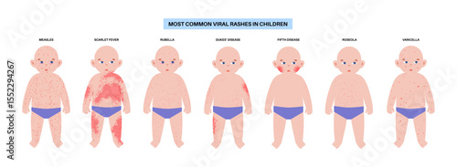 The most common viral rashes