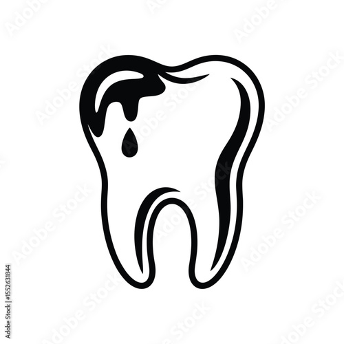 Decayed Tooth with Bleeding Gum Illustration