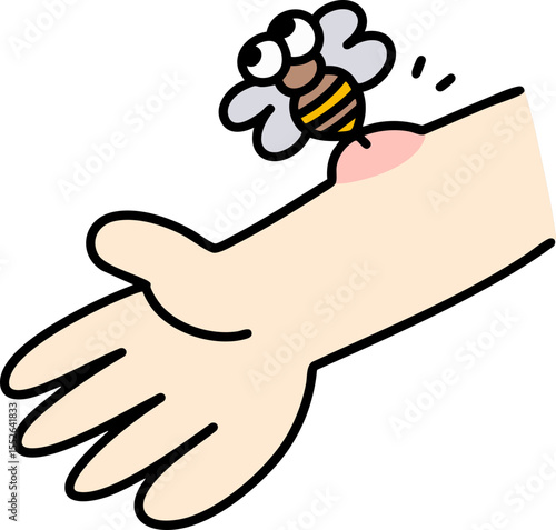 Bee sting