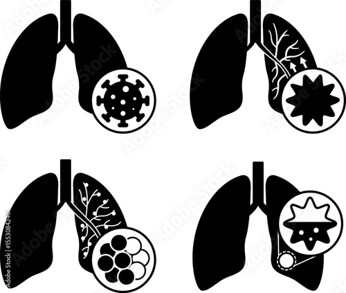 Black Icons of Lung Disease, Bronchitis, COPD, and Pneumonia. Vector Icons of Various Lung Diseases. Healthcare and Medicine