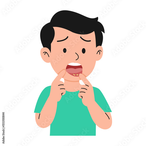 canker sore in mouth. vector illustration