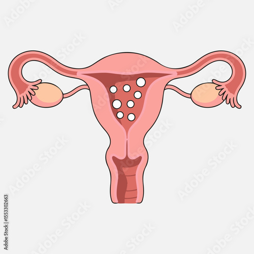 Healthy female uterus