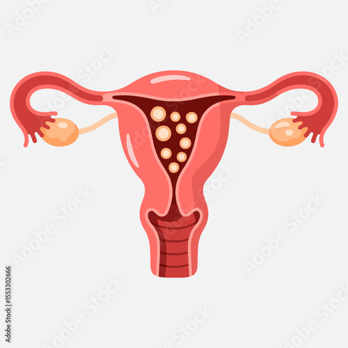 Healthy female uterus