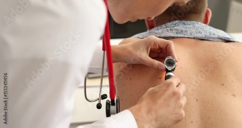 Dermatologist examines back skin of male patient using handheld dermatoscope. Doctor checks birthmarks and moles for asymmetry and color changes