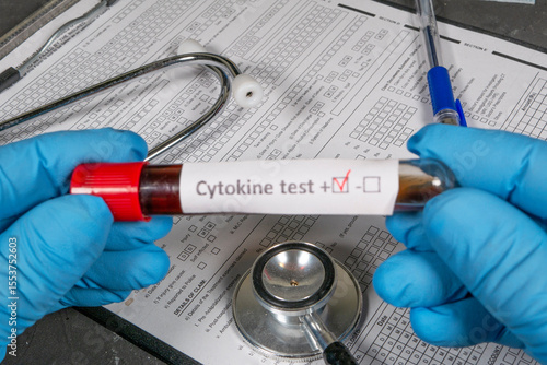 Doctor holding positive cytokine blood test tube and analyzing medical form