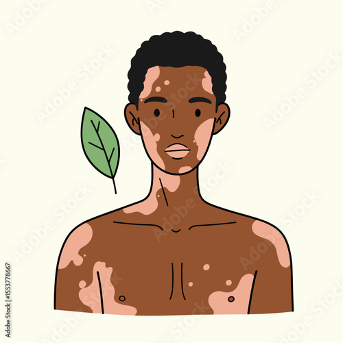 Young black man with vitiligo and leaf illustration on beige background  
