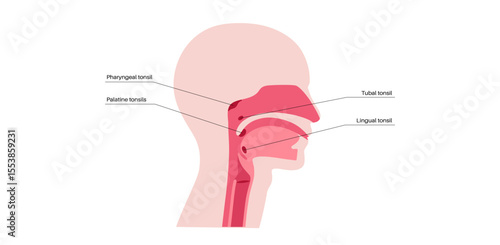 Tonsils anatomical poster