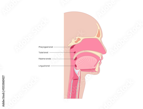 Adenoid medical poster