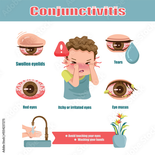 Conjunctivitis causes Symptoms and Prevention