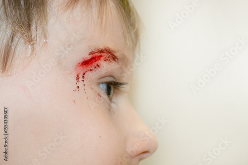 Close-up of the boy's face with a sadina. The child treats the wound on the face. High quality photo