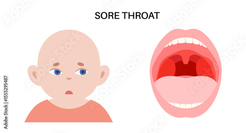 Sore throat poster