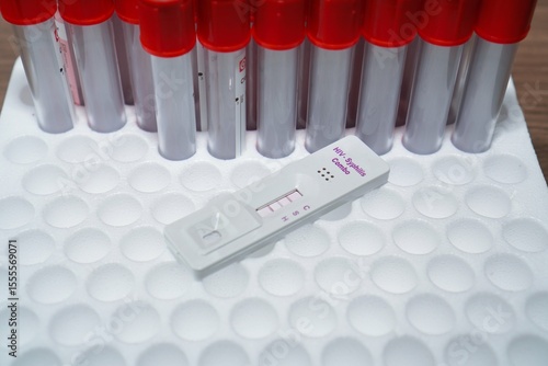 HIV and syphilis rapid test cassette showing positive test result. on top of red vacuum styrofoam tube. rapid test device combo