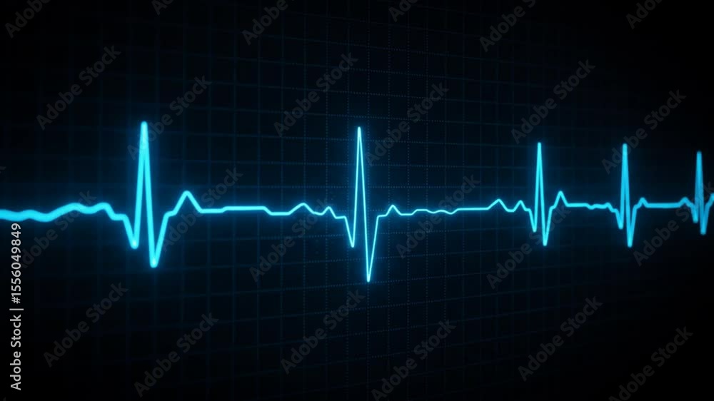 ECG Display Showing Heartbeat Signal Medical Technology ECG Display Showing Heartbeat Signal Medical Technology