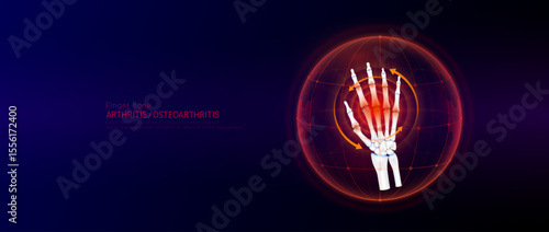 Red rotating arrow around finger joint cartilage inflammation in dome on blue background. Arthritis and osteoarthritis. Human hand skeleton anatomy. Medical science concept. Vector EPS10.