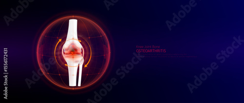Red rotating arrow around knee joint cartilage inflammation in dome on blue background. Arthritis and osteoarthritis. Human leg skeleton anatomy. Medical science concept. Vector EPS10.
