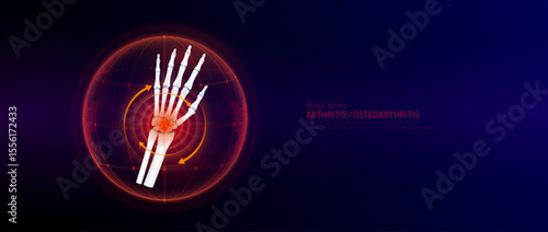 Red rotating arrow around wrist joint cartilage inflammation in dome on blue background. Arthritis and osteoarthritis. Human hand skeleton anatomy. Medical science concept. Vector EPS10.