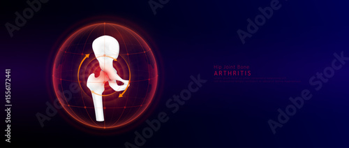 Red rotating arrow around vertebra joint cartilage inflammation in dome on blue background. Arthritis and osteoarthritis. Human femur skeleton anatomy. Medical science concept. Vector EPS10.