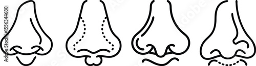 Different Types of Noses: Cartoon Illustration of Four Unique Nose Shapes