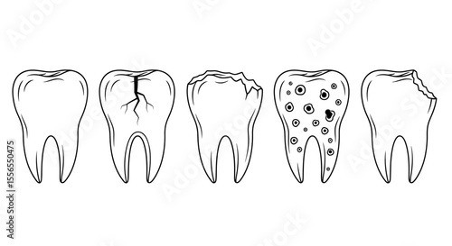 Stages of Tooth Decay From Healthy to Damaged Teeth