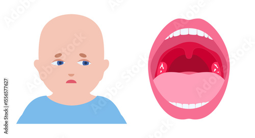 Sore throat poster