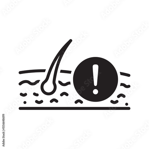 Hair loss problem alopecia concept hair follicle damage thinning baldness dermatology issue treatment needed exclamation mark vector glyph icon solid