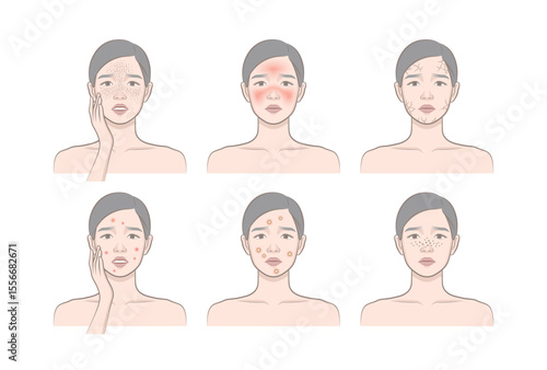 Woman's cosmetic skin trouble_Female character with freckle, blush, dryness, papule, pastule, blackhead