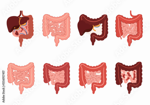 Medical illustrations showing healthy and unhealthy states of the liver and large intestine, representing conditions of the digestive system and internal organs.